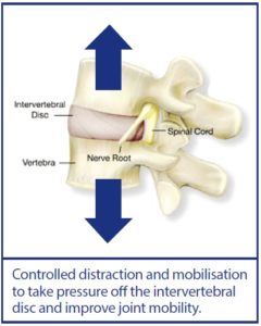 vertebrae-distraction